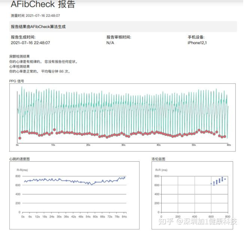 房颤检测报告